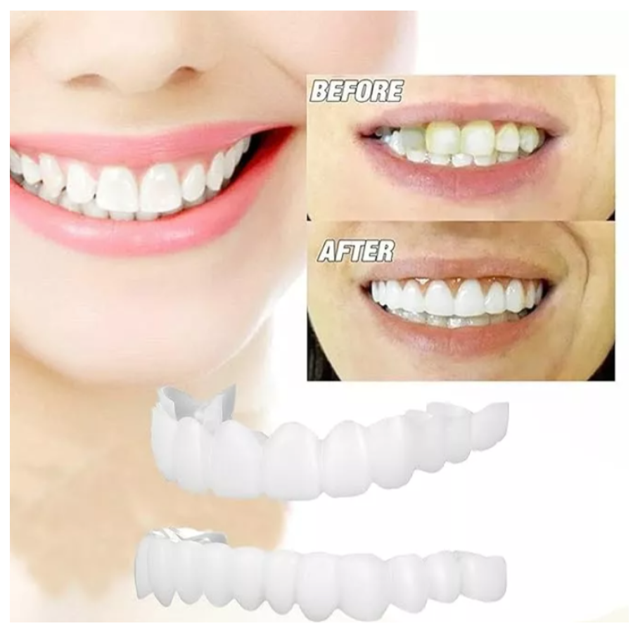 Carillas Dentales Perfecta Sonrisa IMPORTADAS