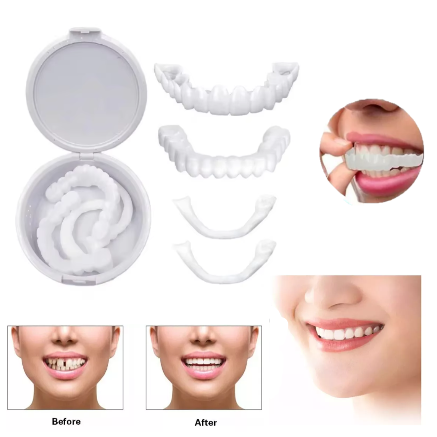 Carillas Dentales Perfecta Sonrisa IMPORTADAS